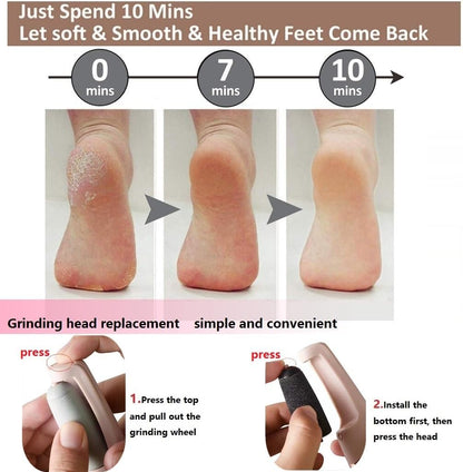 Mini Electric Dead Skin Remover Foot Callus Remover